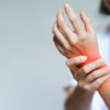 Tendinopathie