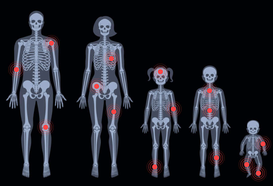 Image de :La chiropratique est-elle seulement pour le dos ? Découvrez tout ce qu’elle peut traiter !